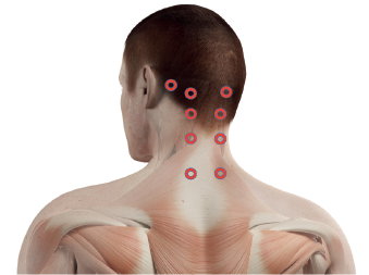 liečba bolesti biodermalne nite Poprad